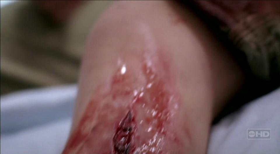 AbbieGreysAnatomy_033.jpg AbbieGreysAnatomy_033.jpg